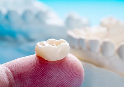 Dental crown on finger