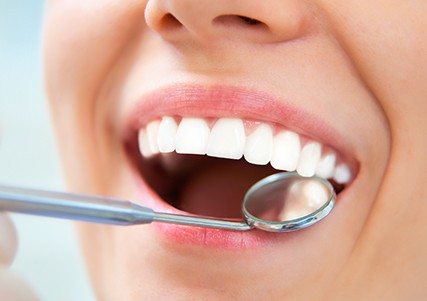 Closeup of smile during dental exam