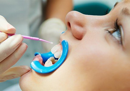 Child receiving fluoride treatment