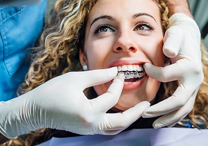 Dentist putting clear aligner on patient