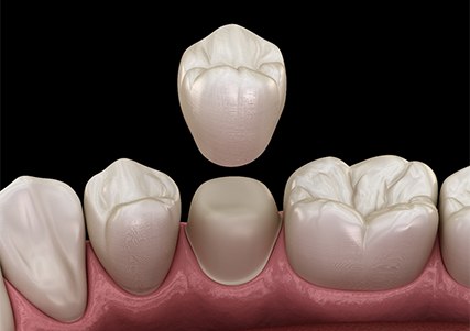 Dental crown and tooth