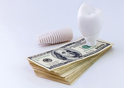 Dental implant on stack of cash