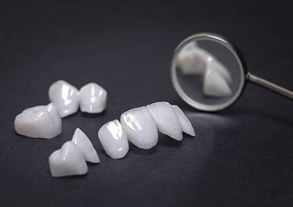 Dental restorations for full mouth reconstruction.