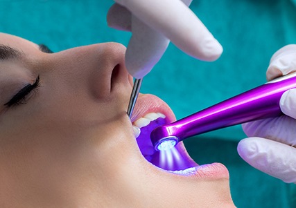 Sealants being hardened