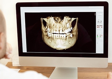 Digital x-rays on computer screen