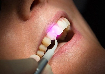 Patient receiving laser dentistry treatment